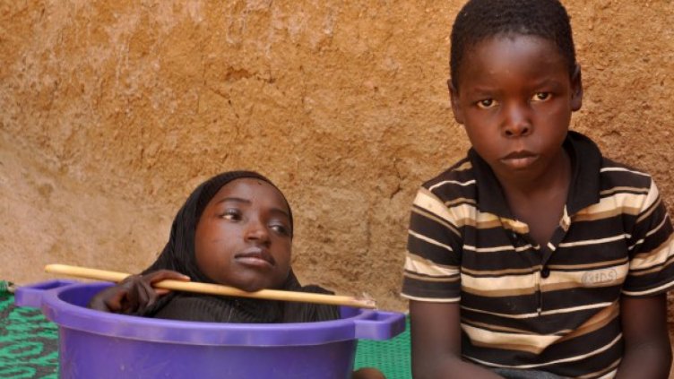 Когато медицината е безсилна: Живот в леген!