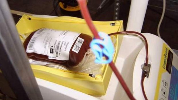 Мъж от Русе почина, преляли му заразена кръв от чужденец