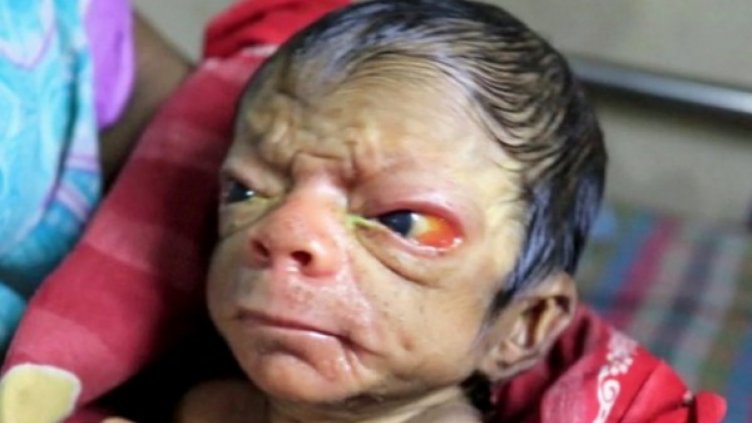 Току-що родено, а вече като 80-годишен дядо