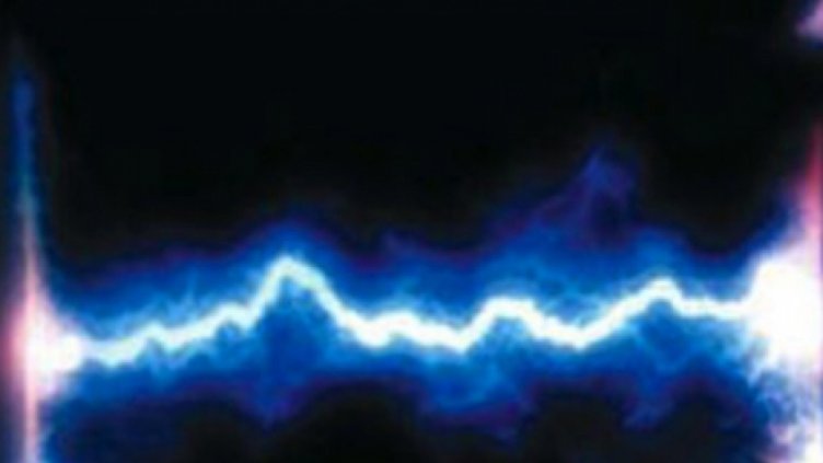 Волтова дъга обгори тежко 14-годишен във Варна