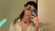 След втори ковид: Кристиян Костов не може да вижда и спи