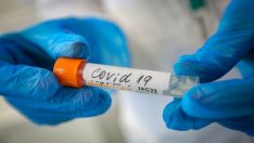 101 са новите случаи на COVID у нас
