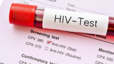 Днес е Международен ден за съпричастност със засегнатите от ХИВ и СПИН