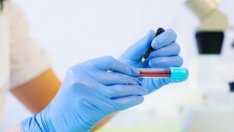 Кръвен тест показва как ще прекараме COVID