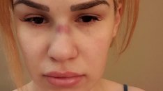 Родна риалити звезда пропищя от домашно насилие (СНИМКИ)