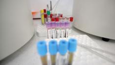 115 нови случая на COVID, 15 от които са във Варна