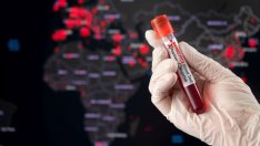 СЗО обяви извънредна ситуация заради маймунската шарка