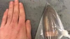 Сапьори вадят снаряд от... пациент. Деликатна е операцията, при това много