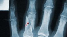 Мъж от Синдел чупи пръсти в центъра на Варна