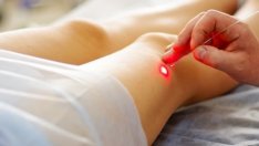 Според ТЕЛК-овете: Млади и здрави хора масово са с разширени вени!  