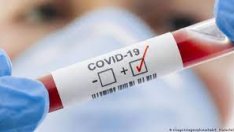 131 ковид случая във Варна. Скок на заразата, която отне нови 139 живота