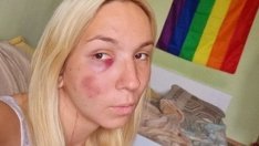 Бус помля Емили с тротинетката, откриха й наркотици