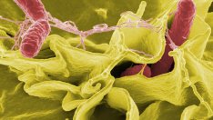 Регистрираха случаи на салмонела и вирусен хепатит във Варна