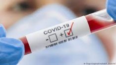 Бум на COVID заразата у нас: 774 нови положителни, 23-ма души са починали