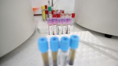 93 жертви и отново над 10 хил. заболели - над 20% от тях с бити ваксини