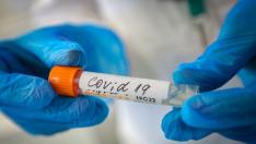 Търси се плазма за уважаван варненски лекар с COVID-19