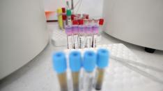 Под 50 паднаха ковид случаите у нас. 8 от тях са във Варна – №2 сме!