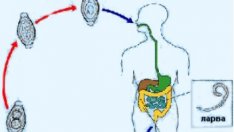Регистрираха 8 случая на специфично тропическо заболяване във Варна