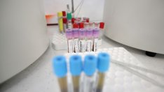 4 нови случаи на COVID и трима излекувани за последното денонощие