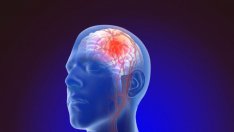 Варна е първенец по инсулти у нас, а България е на първо място в Европа