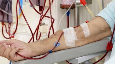 Още две счупени машини в хемодиализата във Видин