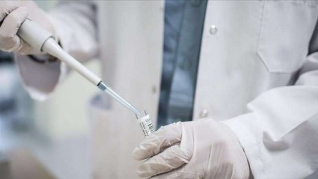 Учени разработват нова ваксина срещу ебола