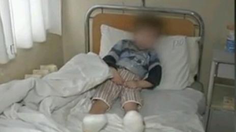 Местят в "Пирогов" момченцето с измръзнали крачета от Долна Липница