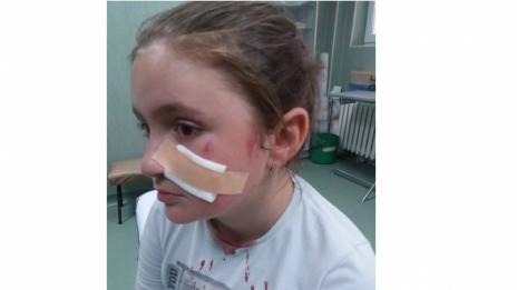Момче обезобрази съученичка в Шумен