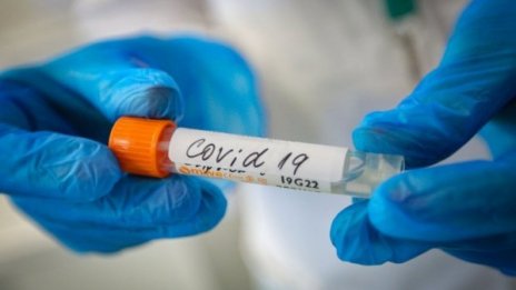 12 нови случаи на COVID за последното денонощие