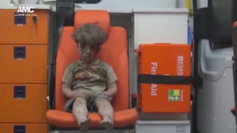 Почина братчето на сирийското момче, което трогна света