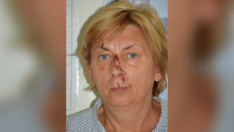 И тя е… Словачката Даниела открита с амнезия на хърватския остров Крък