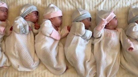 29-годишна жена роди шестзнаци