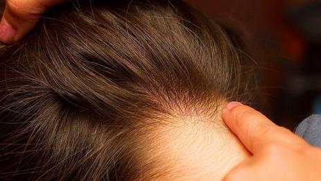 Ще проверяват за въшки учениците всяка седмица