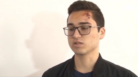 18-годишен ошамарен от полицай, хвърлил си фаса на земята. Кой крив, кой прав?