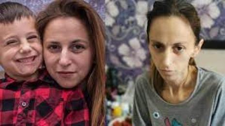 Ражда сина си без ръчичка, после чува: Имаш рак! Нели има нужда от нас