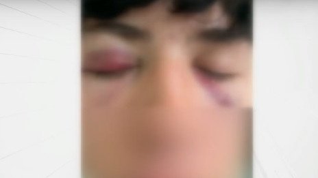 При спор за цигара: Дете е в болница след побой от младеж