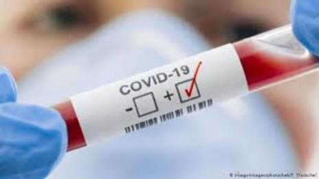 618 са потвърдените случаи на COVID-19 у нас