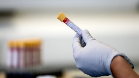 Черният списък на МЗ: COVID-19 отне живота на 48-годишен здрав мъж