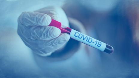 15 са новите случаи на COVID-19 днес