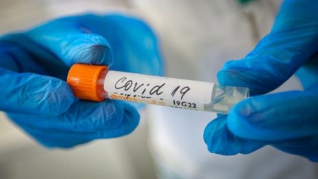 10 са новите случаи на COVID за последното денонощие в страната