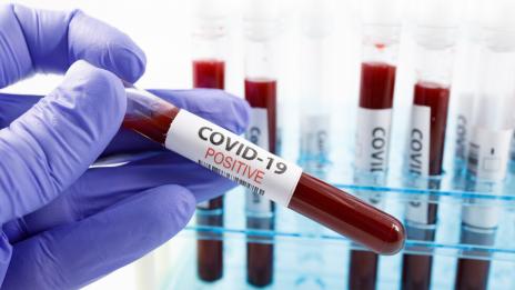 Случаите на заразени с COVID-19  у нас са вече 62