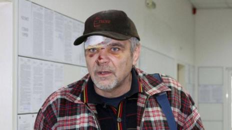 Пребиха поета, обидил девствената колежа