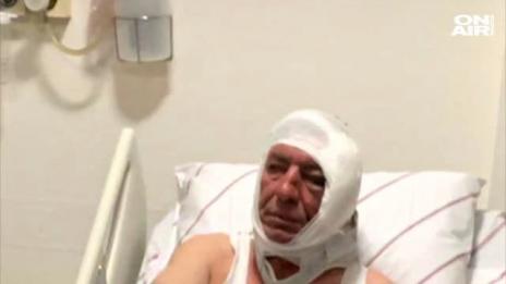 Пребиха журналист критикувал Ердоган