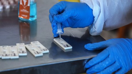 28 фирми дадоха оферти за щадящи тестове за ученици