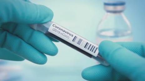 31 положителни проби за COVID-19 у нас през последното денонощие