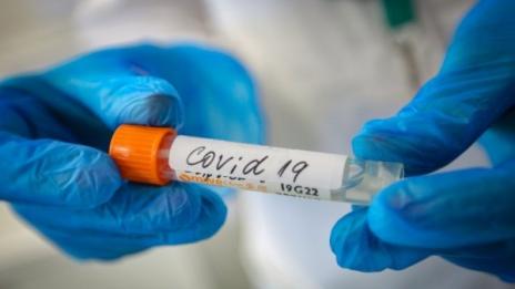 COVID рекорди: 2760 новозаразени – 28 % от тестваните, 36 починали