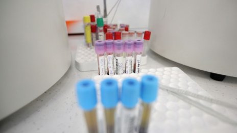 Срив на коронавируса, но жертвите му все си растат – 37 019 от началото