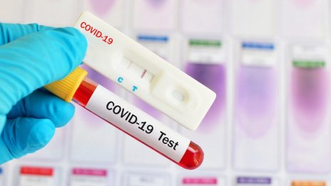 Нов ръст на случаите на COVID у нас - 500 заразени и 14 починали за ден