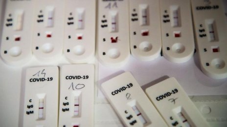 36 нови случаи на COVID у нас, 3 от тях са от Варна