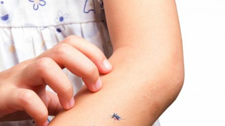 147 души са заразени с вируса "Зика" в САЩ